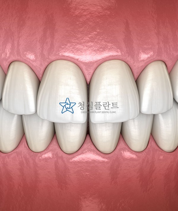 전후사진 준비중입니다.